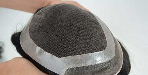 Hair Patch Service