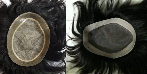 Hair Patch in Delhi