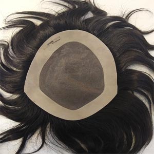 Hair Patch in Delhi