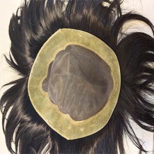 Hair Patch in Delhi