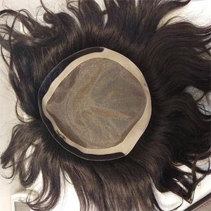 Hair Patch in Delhi